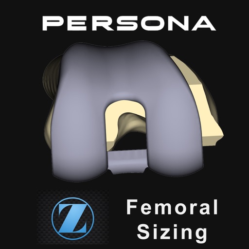 Persona® TKA Femoral Sizing