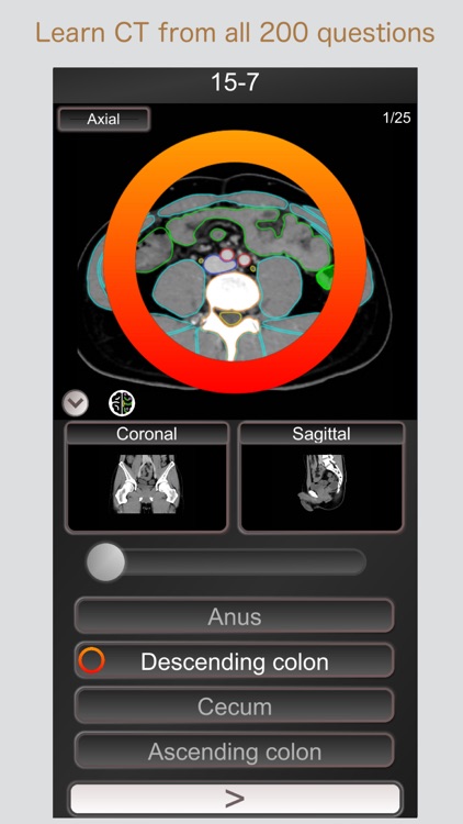 CT PassQuiz Abdomen / MRI