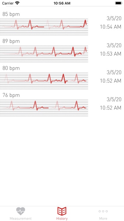 Cardiograph Heart Rate Monitor screenshot-3