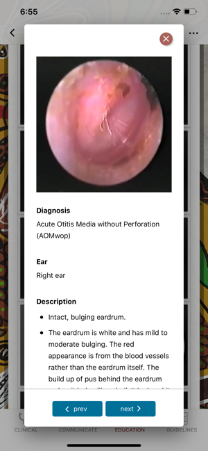 Otitis Media Guidelines(圖4)-速報App