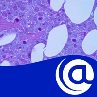 Multiple Myeloma [MM]