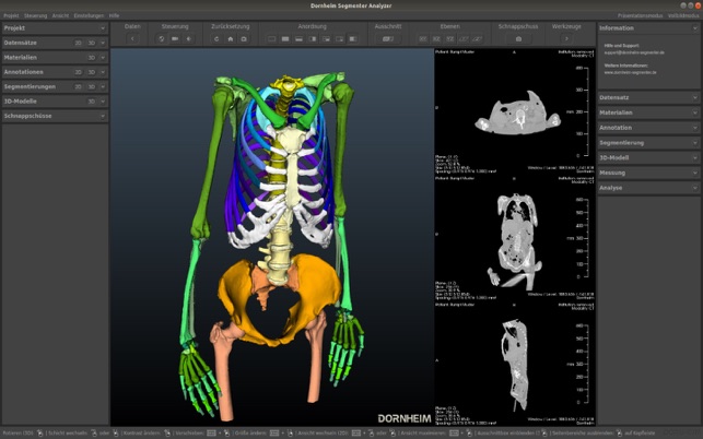 Dornheim DICOM Viewer