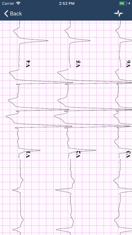 ECG Guide