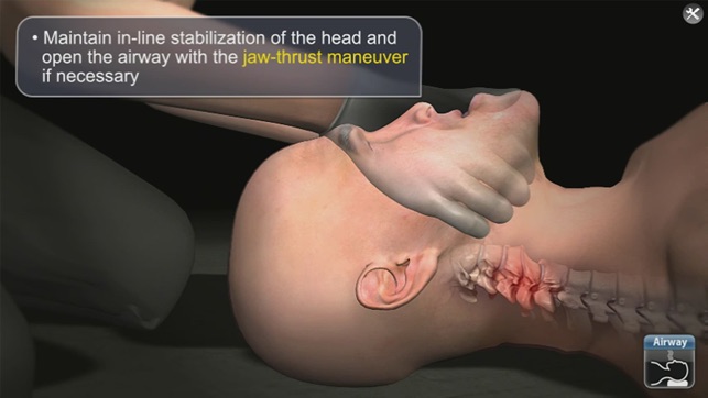 Medrills: Spinal Cord Injury(圖5)-速報App