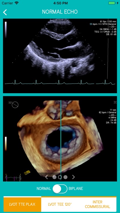 Mitral View screenshot-3