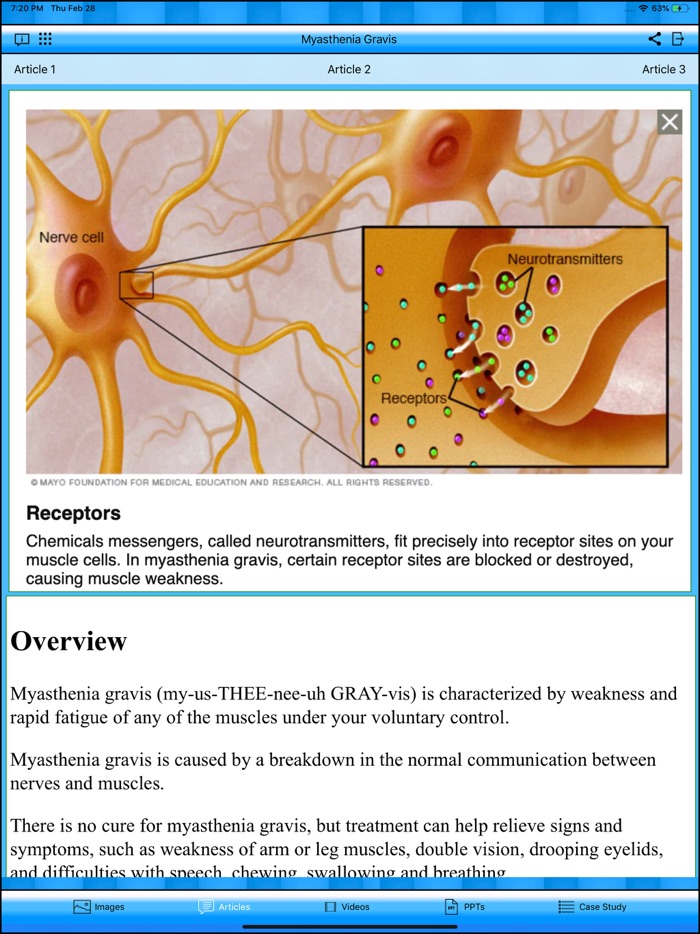 Myasthenia Gravis