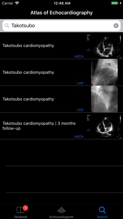 CARDIO3®Echocardiography screenshot-4