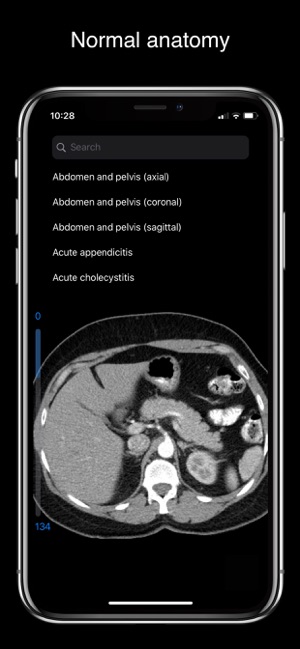 MAD Radiology(圖2)-速報App