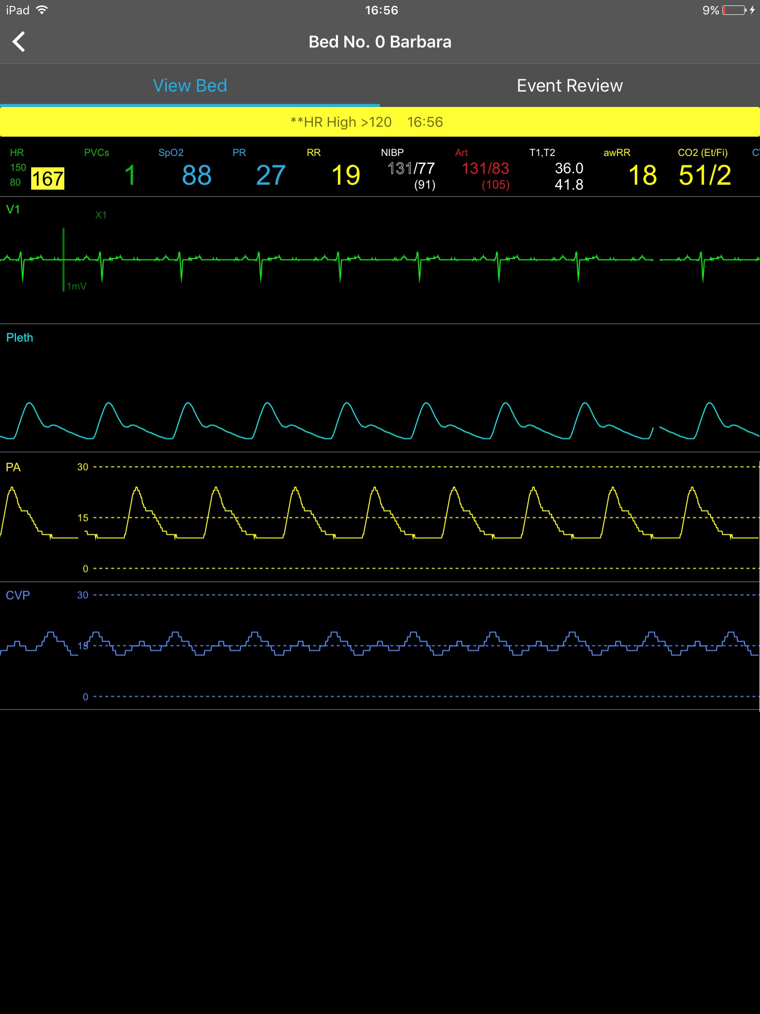 Mindray Mobile Viewer（FDA） screenshot 3