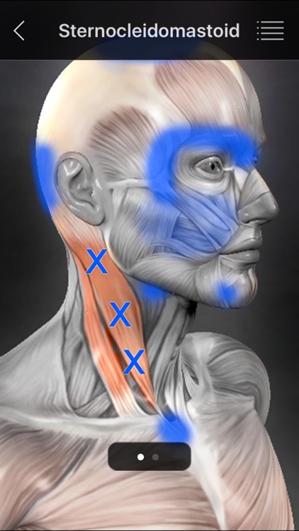 Muscle Trigger Points