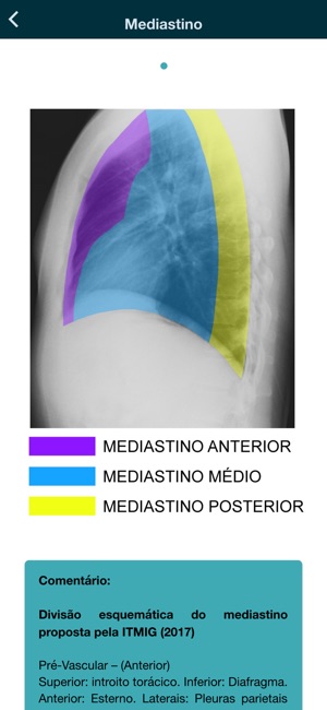 DIAX Tórax - Radiologia(圖4)-速報App