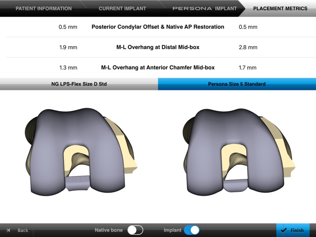 Persona® TKA Femoral Sizing(圖3)-速報App