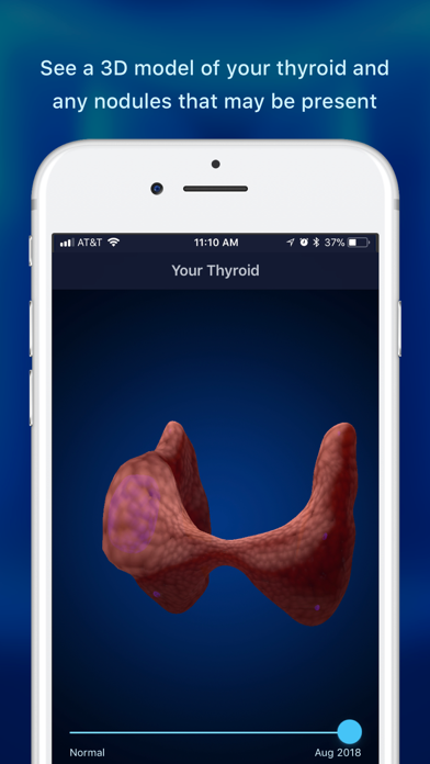 Thyroid Nodule & Cancer Guide screenshot 2