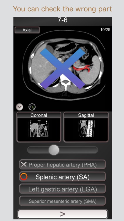 CT PassQuiz Abdomen / MRI