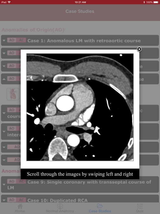 CTisus CT Coronary Arteries(圖6)-速報App