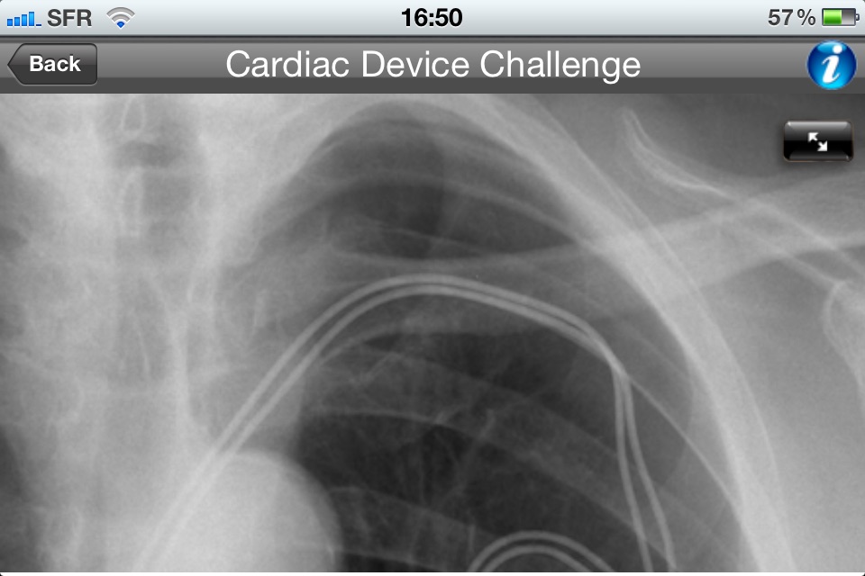 Cardiac Device Challenge screenshot 3