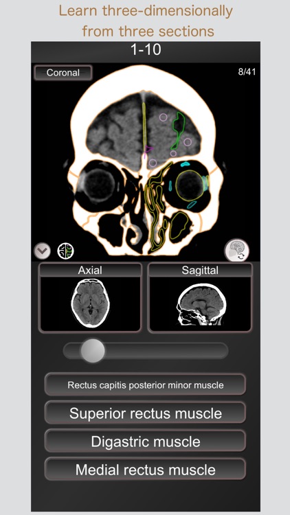 CT PassQuiz Head/Brain / MRI