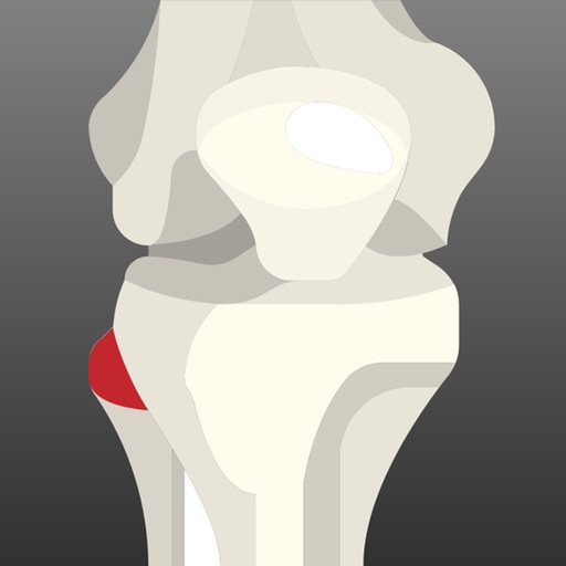 Peroneal Nerve Therapy