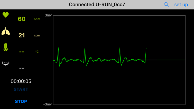 SMP ECG