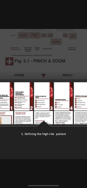 Antithrombotic Therapy(圖6)-速報App