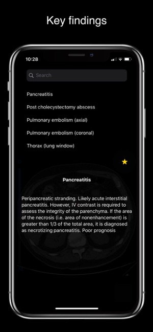 MAD Radiology(圖4)-速報App