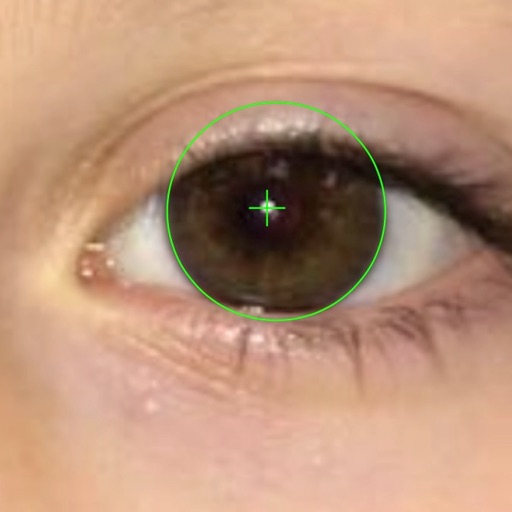 EyeStrab