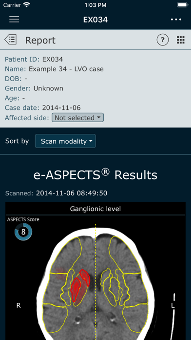 Brainomix 360 Mobile screenshot 2