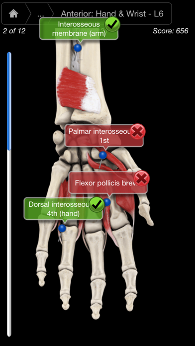 Muscle System Pro III - iPhone Screenshots