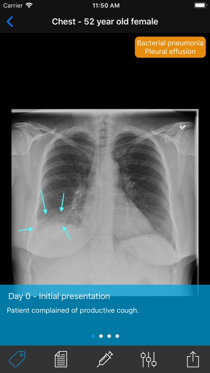 Normal X-Rays and Real Cases screenshot-4