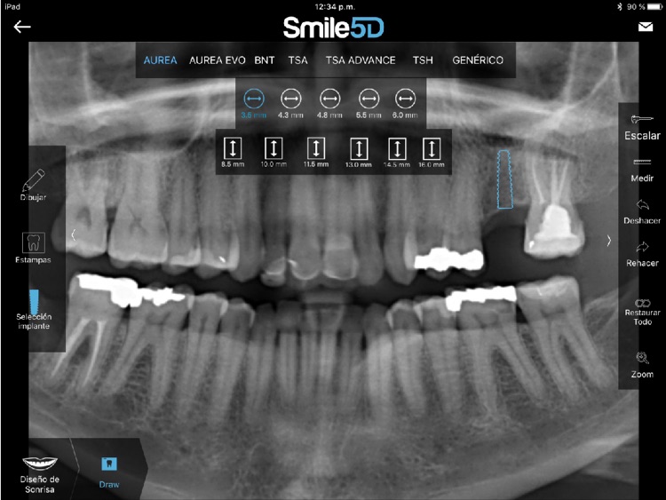 Smile5D