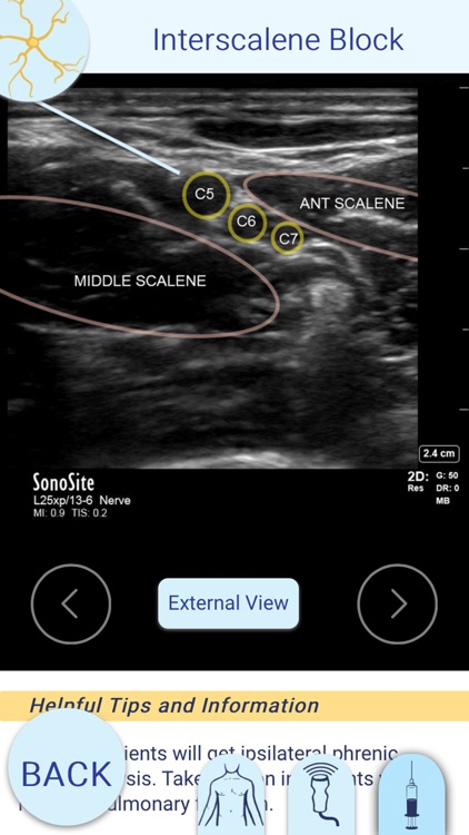 Nerve Block Star App screenshot-3