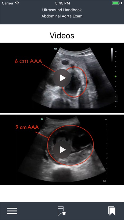 Emergency Ultrasound Handbook screenshot-3