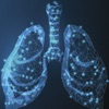 Severe Asthma AR