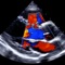 EchoLab presents the formulas and algorithms used daily in the adult echocardiography laboratory