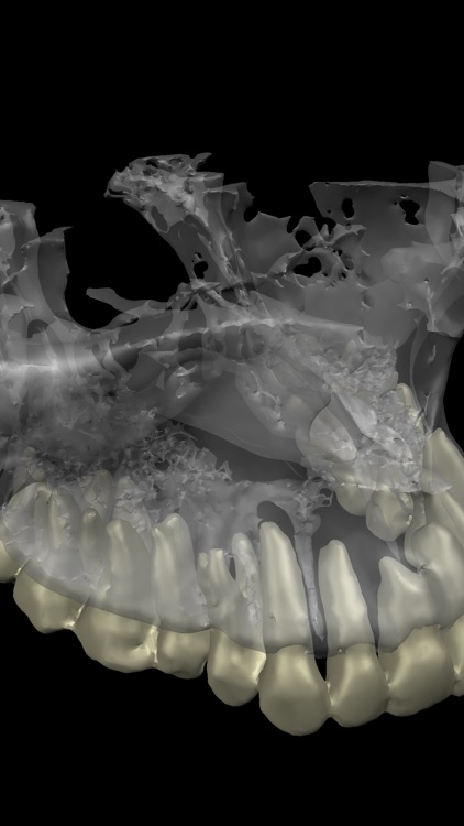 Dental CT View screenshot-9