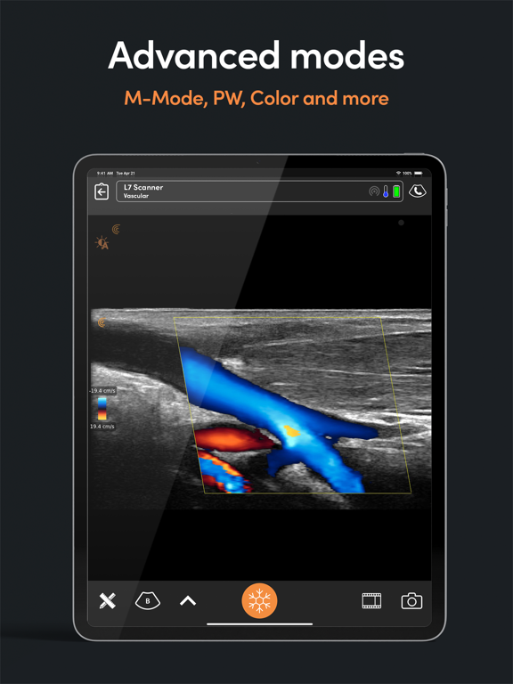 Clarius Ultrasound App screenshot 4
