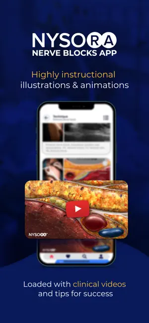 Captura 3 NYSORA Nerve Blocks iphone