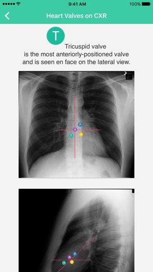 Radiology Toolbox Pro(圖5)-速報App