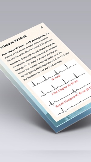 ECG心電圖书Pro - ECG (EKG) Books(圖1)-速報App