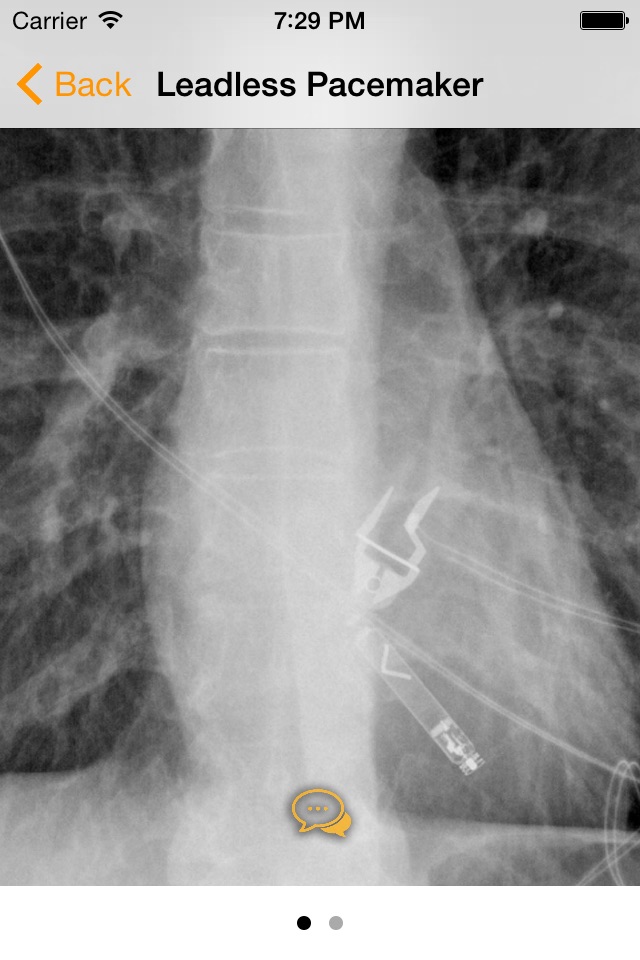 Medical Devices on Chest X-Ray screenshot 2