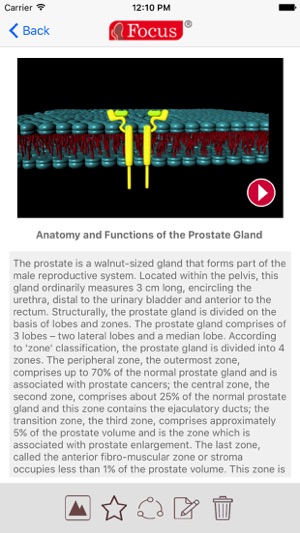 Animated Atlas of BPH and OAB(圖3)-速報App