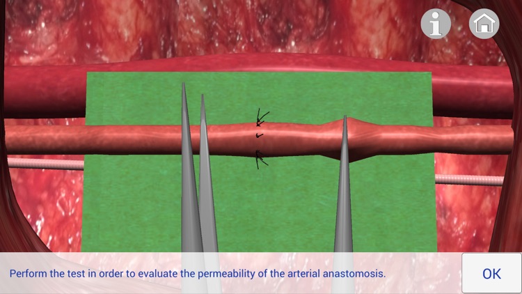 Microsurgery 3D