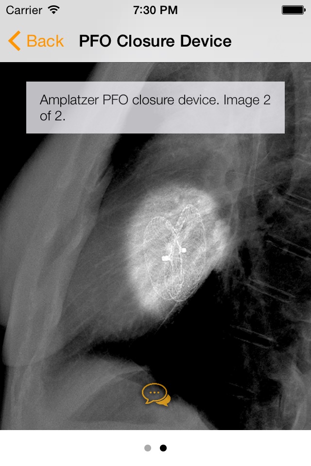 Medical Devices on Chest X-Ray screenshot 3