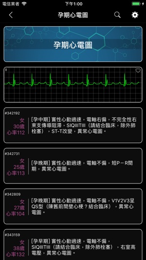 ECG - 海量心電圖案例和診斷詳解(圖9)-速報App