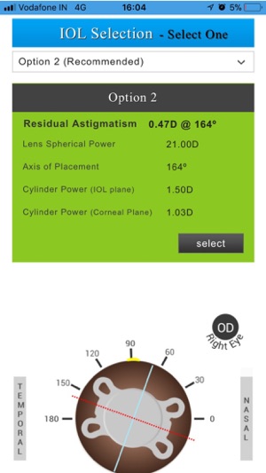 Axis Toric Calculator(圖6)-速報App