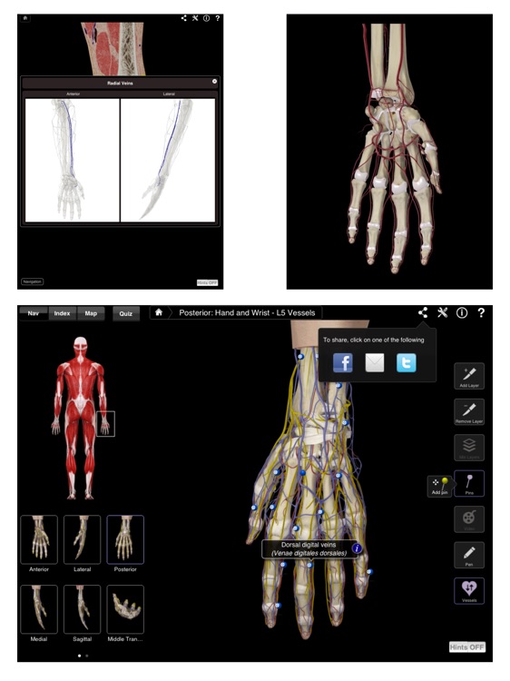 Hand & Wrist Pro III for iPad screenshot-4