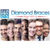 Diamond Braces