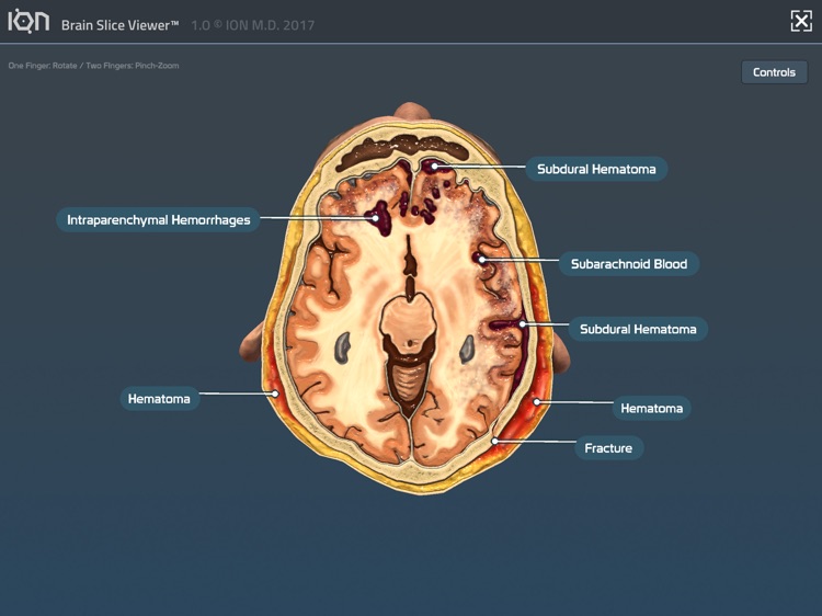 ION Brain Slice Viewer screenshot-4