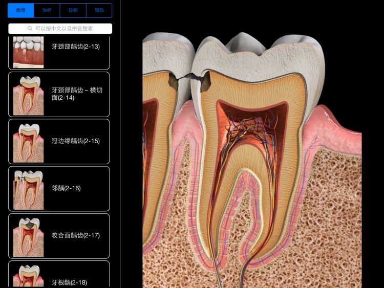 3D口腔医患沟通