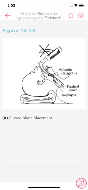 MGH HBK of Clinical Anesthesia(圖6)-速報App